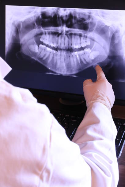 Best Emergency Wisdom Teeth Removal in Russells Point, OH