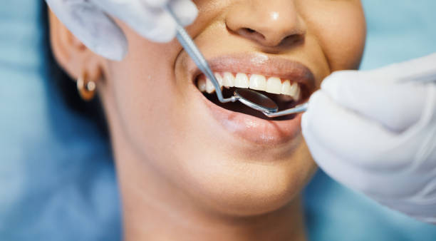 Best Emergency Tooth Extraction in Russells Point, OH