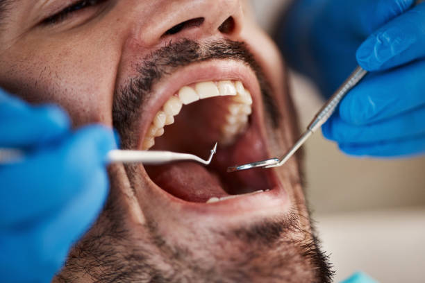Best Emergency Denture Repair in Russells Point, OH