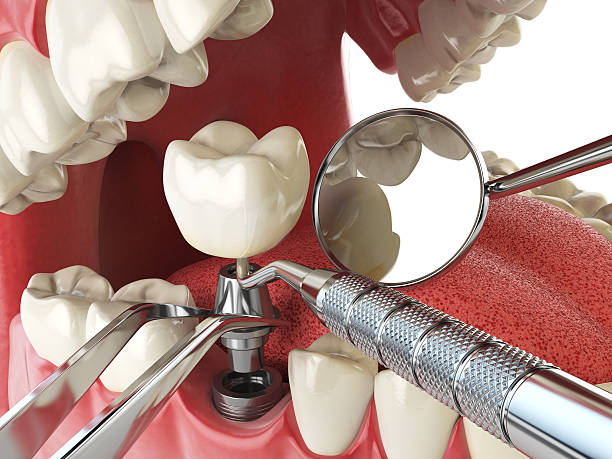 Best Pediatric Emergency Dentist in Russells Point, OH