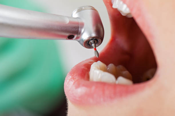 Best Weekend Emergency Dentist in Russells Point, OH